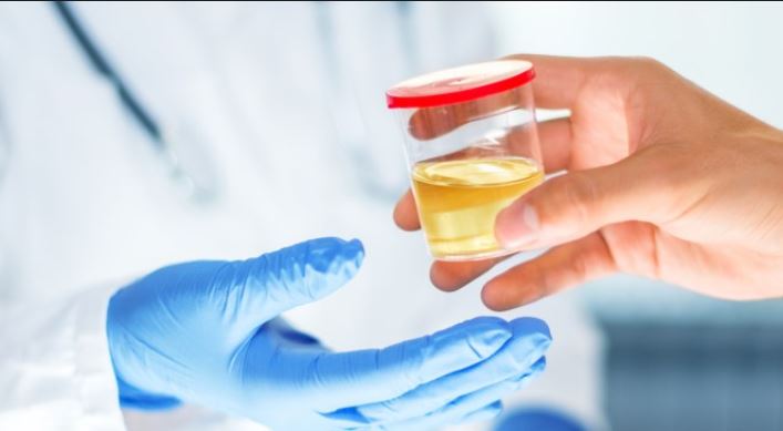 Real powder urine drug testing help